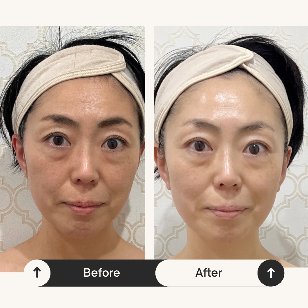 200C24FB-4124-4E5D-879F-EEBD0A8C2235_1_102_o