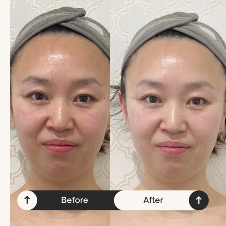 Read more about the article 40代