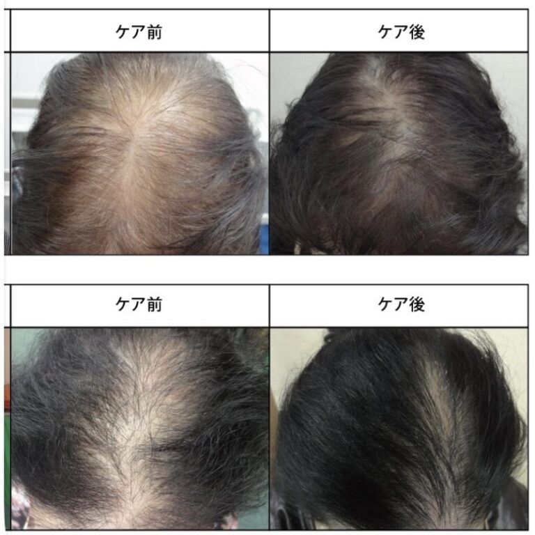 Read more about the article 